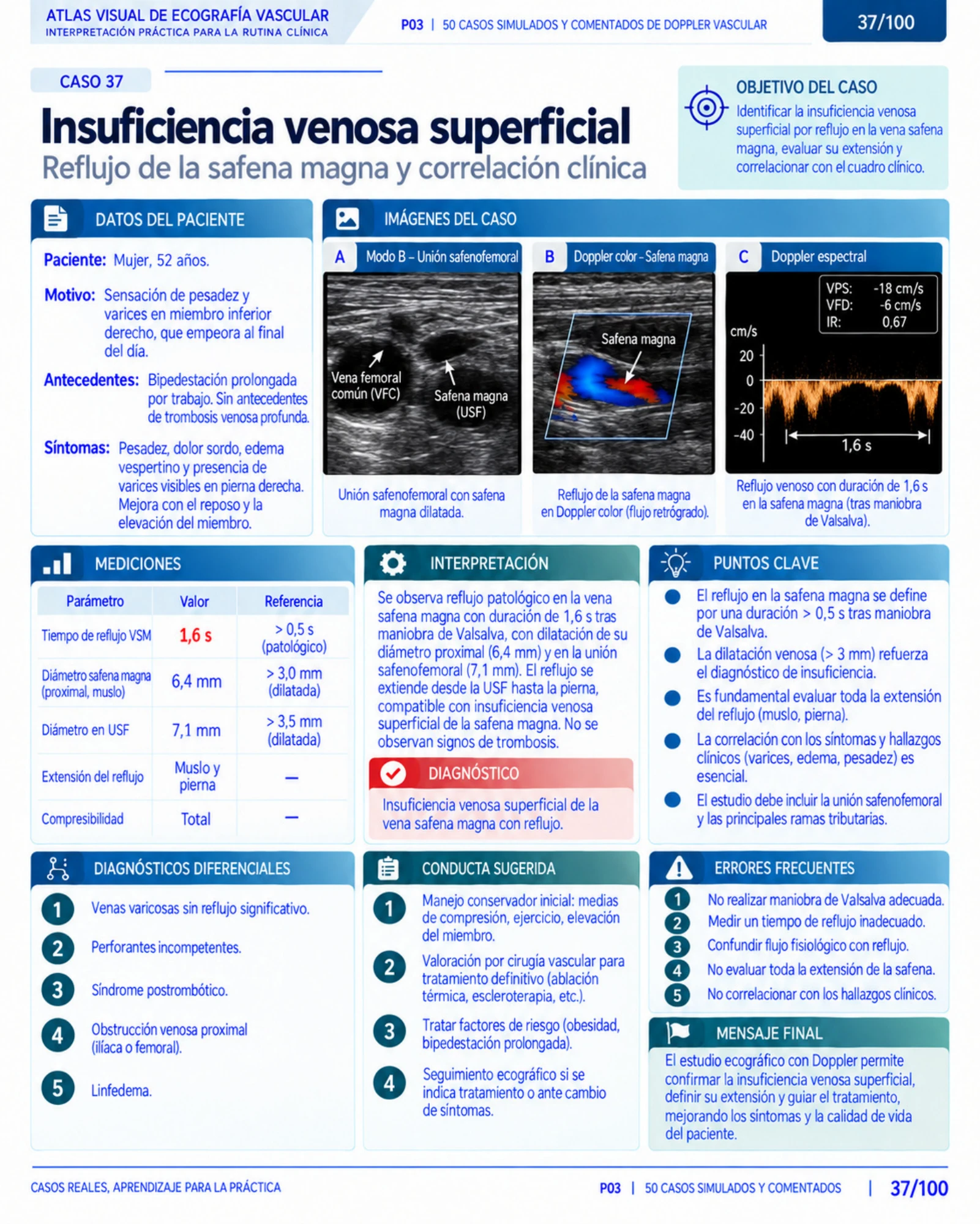 Página 37: Caso: edema pulmonar agudo. Muestra del material digital de radiografía de tórax.
