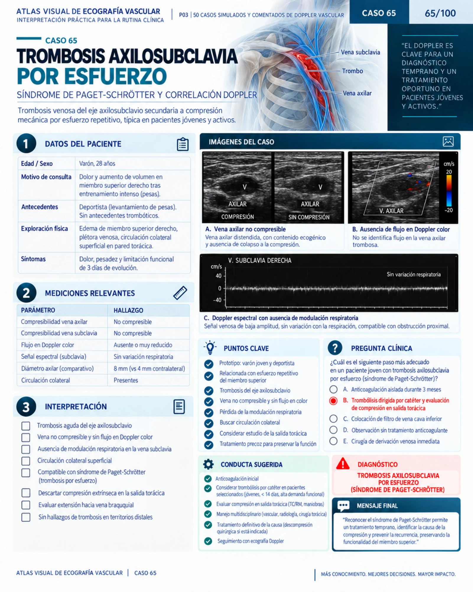 Página 65: Caso: derrame pleural masivo. Muestra del material digital de radiografía de tórax.
