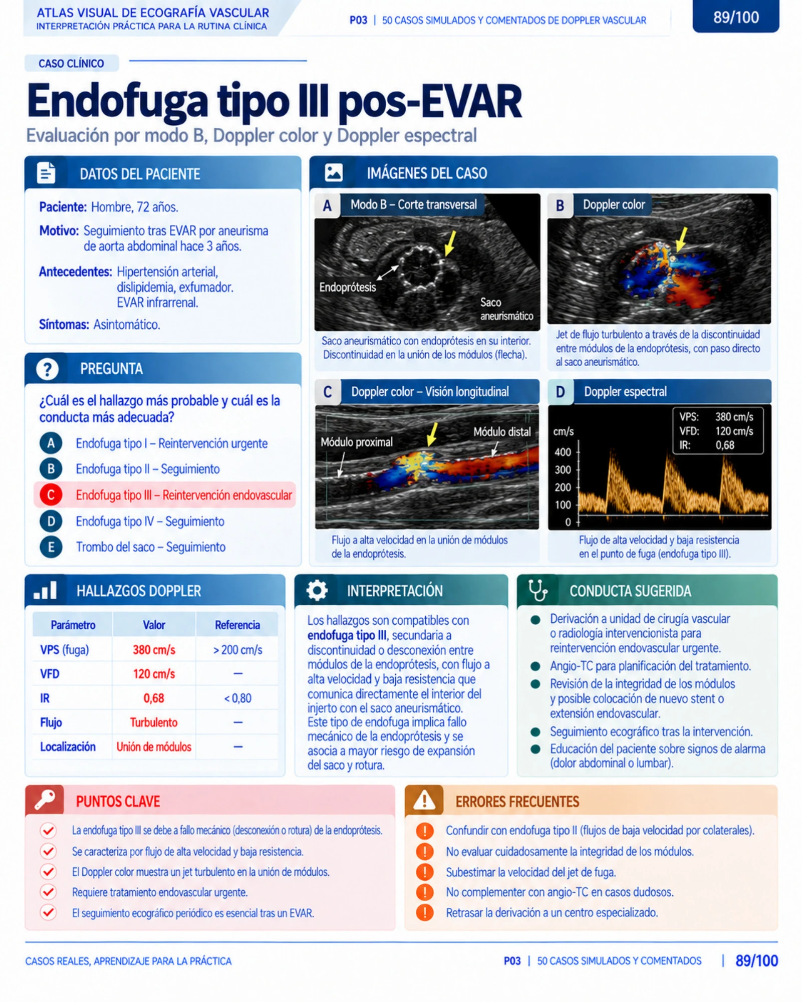 Página 89: Caso: neumomediastino. Muestra del material digital de radiografía de tórax.