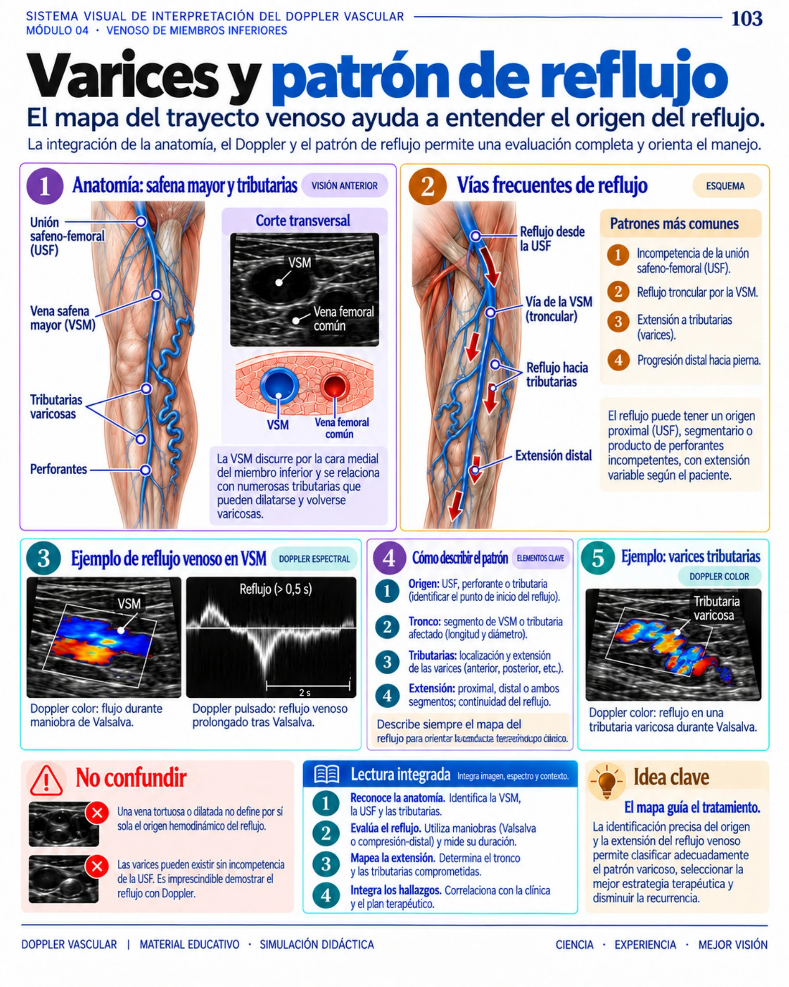 Página 103: Derrame pleural y signo del menisco. Muestra del material digital de radiografía de tórax.