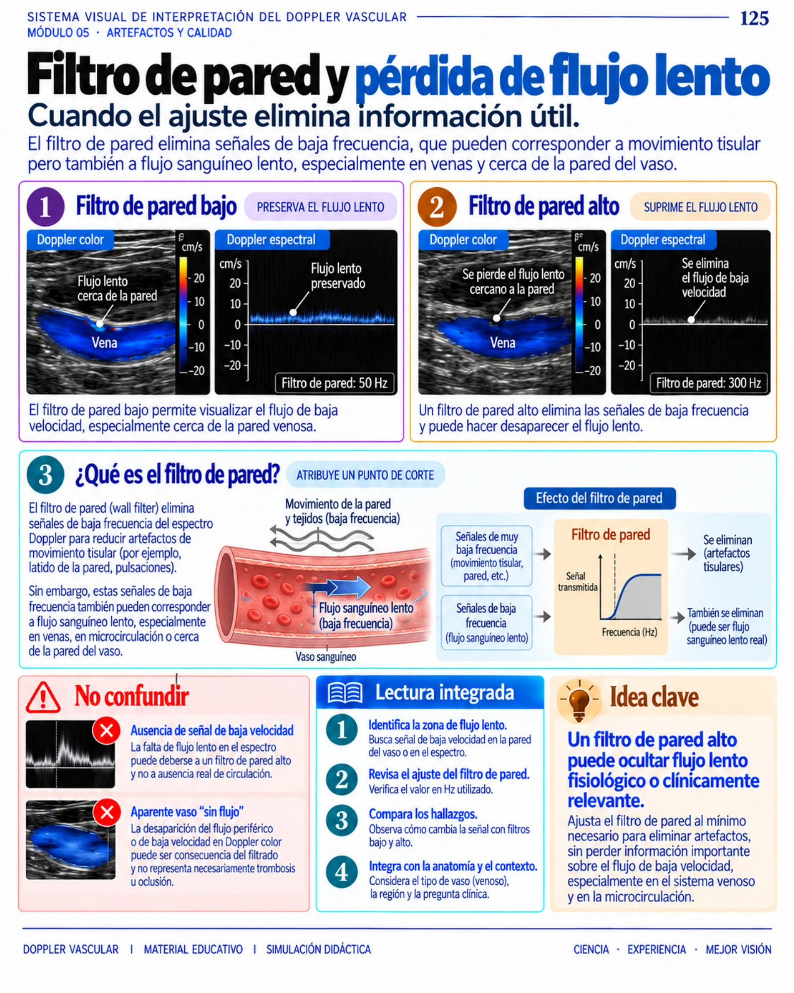 Página 125: Neumotórax: línea pleural y trama periférica. Muestra del material digital de radiografía de tórax.
